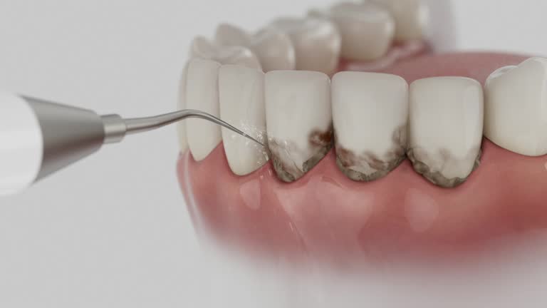 Reliable Dental contractor in Elmer, NJ by Smile Center Dentistry